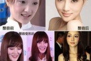 济南整容谁爆料的视频最多,揭秘网络热议背后的真相